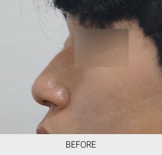 �Խñ� �����