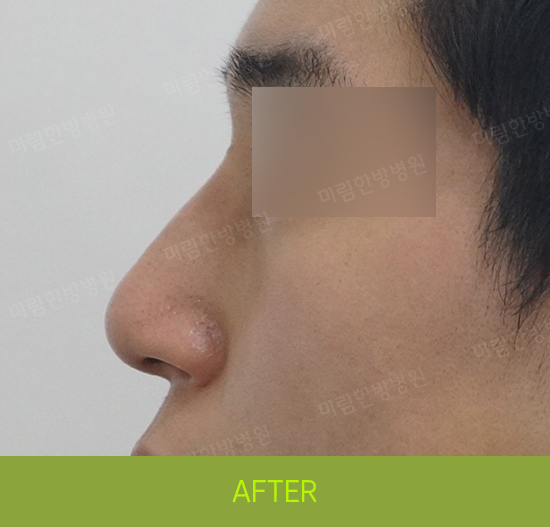 �Խñ� �����