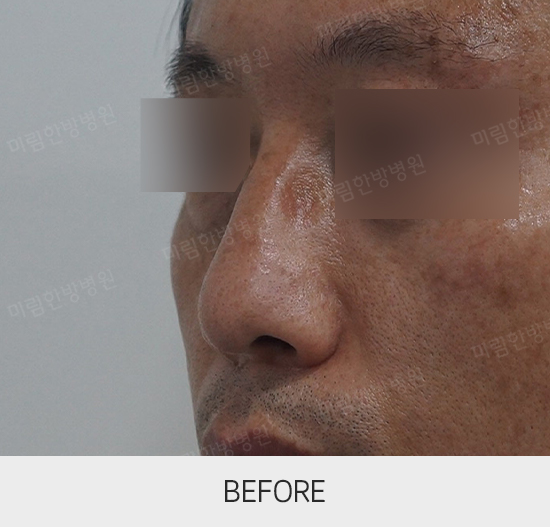 �Խñ� �����