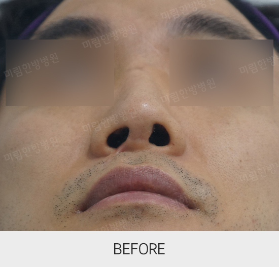 �Խñ� �����