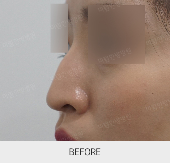 �Խñ� �����