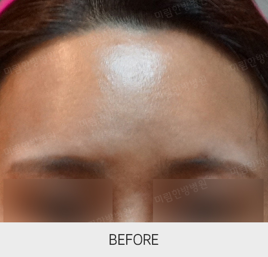 �Խñ� �����