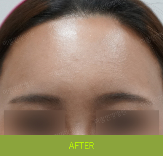 �Խñ� �����