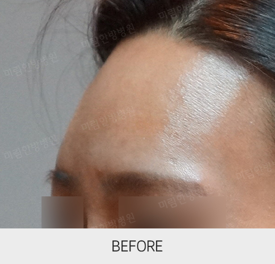 �Խñ� �����