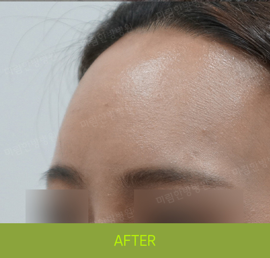 �Խñ� �����