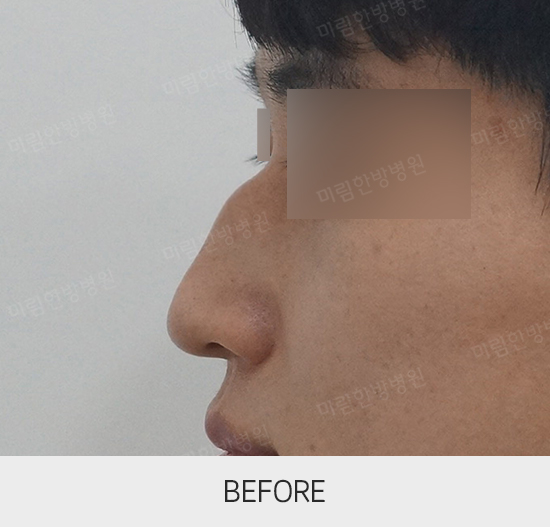 �Խñ� �����