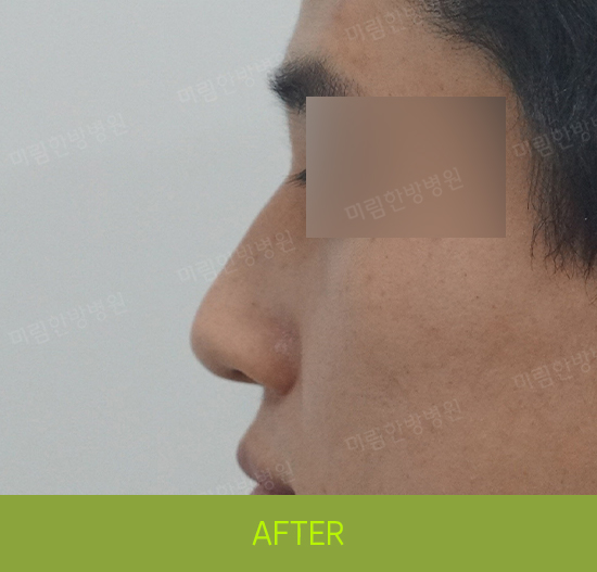 �Խñ� �����