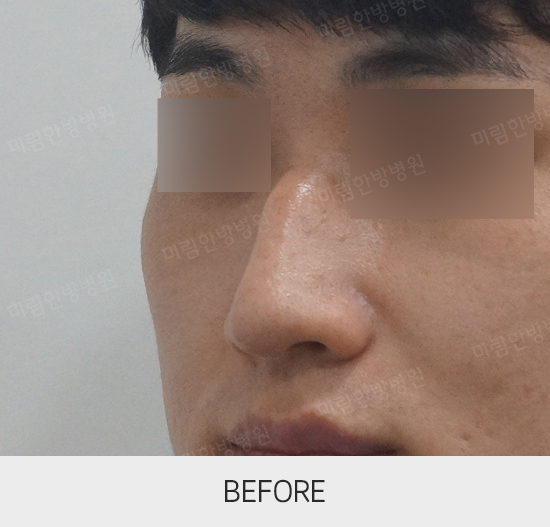 �Խñ� �����