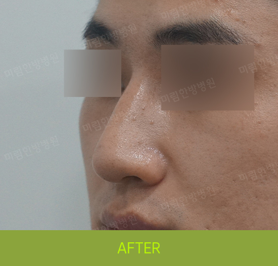 �Խñ� �����