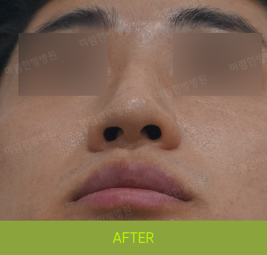 �Խñ� �����