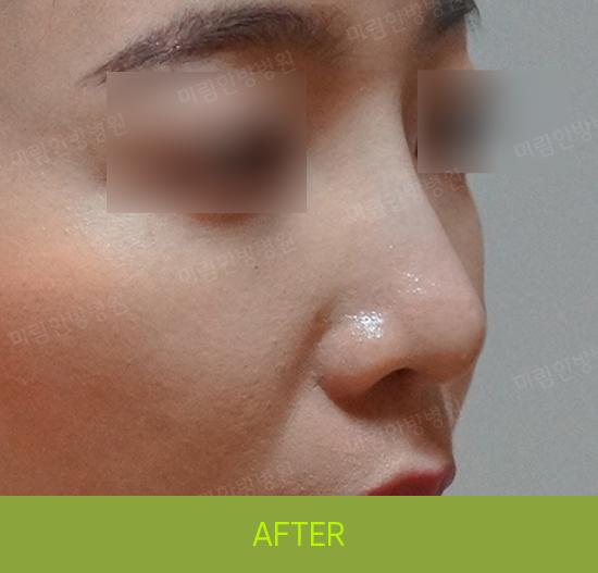 �Խñ� �����