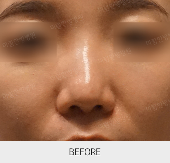 �Խñ� �����