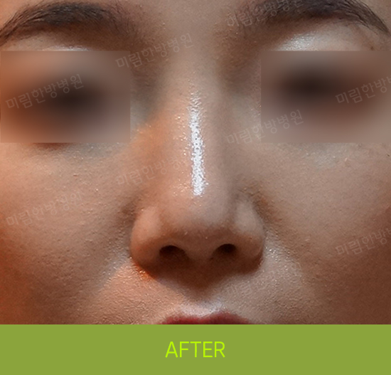 �Խñ� �����