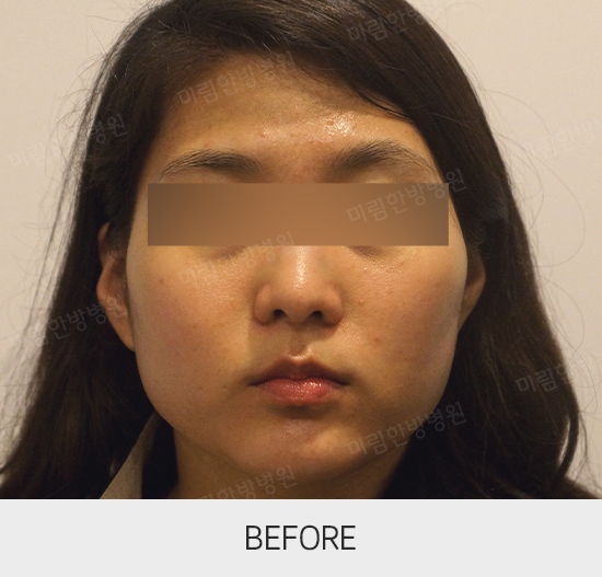 �Խñ� �����