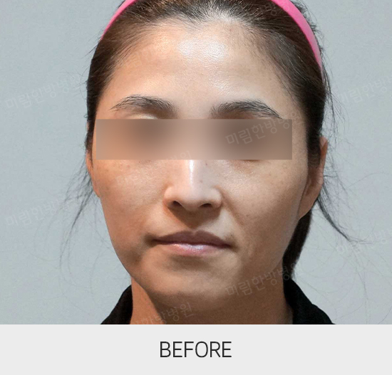 �Խñ� �����