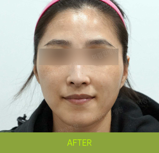 �Խñ� �����