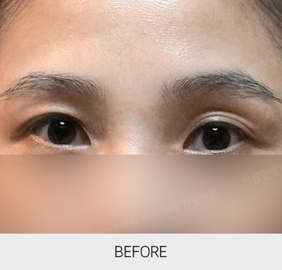 �Խñ� �����