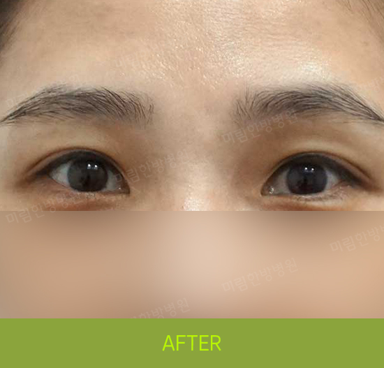 �Խñ� �����