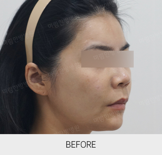 �Խñ� �����