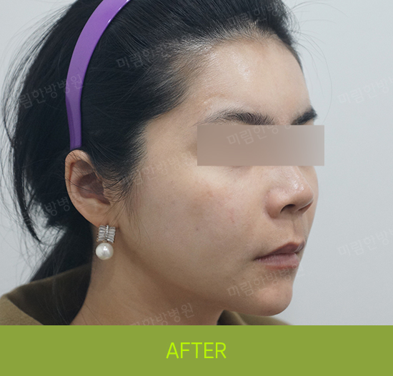 �Խñ� �����