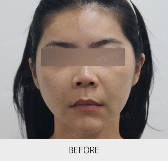 �Խñ� �����