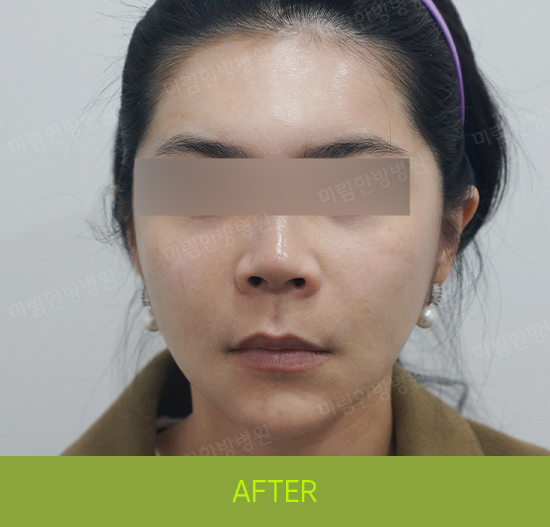 �Խñ� �����