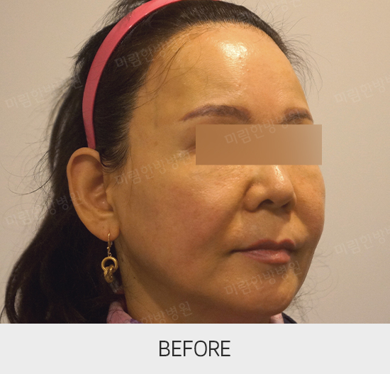 �Խñ� �����