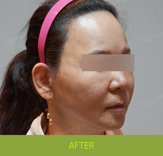 �Խñ� �����