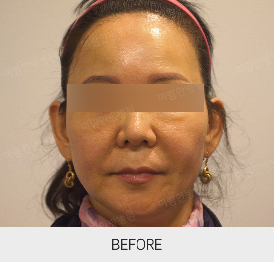 �Խñ� �����