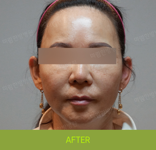 �Խñ� �����