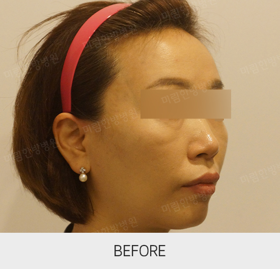 �Խñ� �����