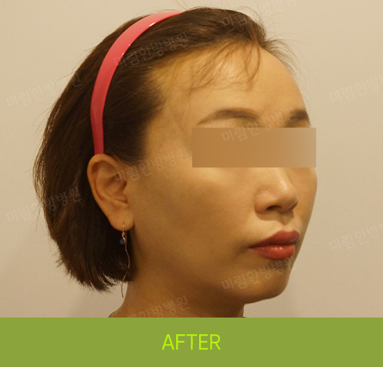 �Խñ� �����