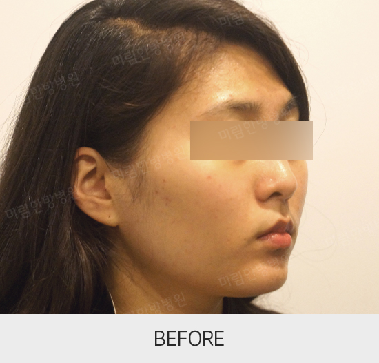 �Խñ� �����