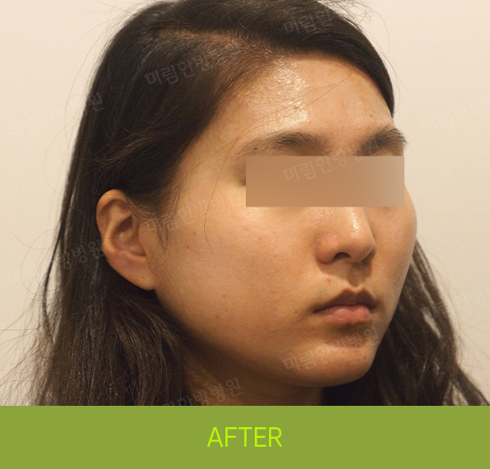 �Խñ� �����