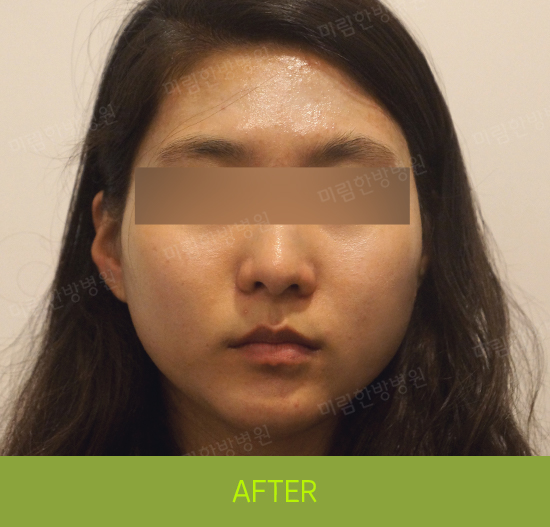 �Խñ� �����