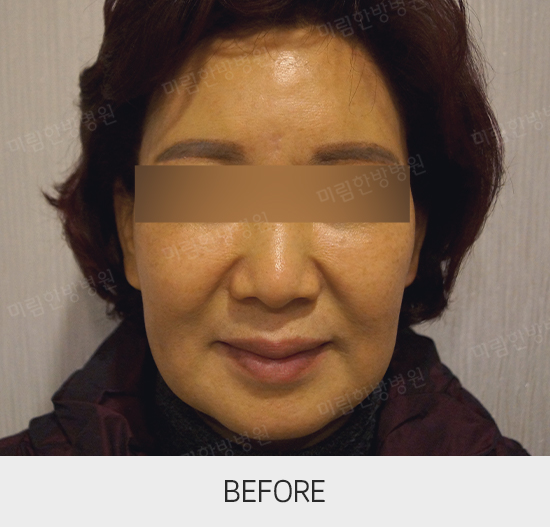 �Խñ� �����