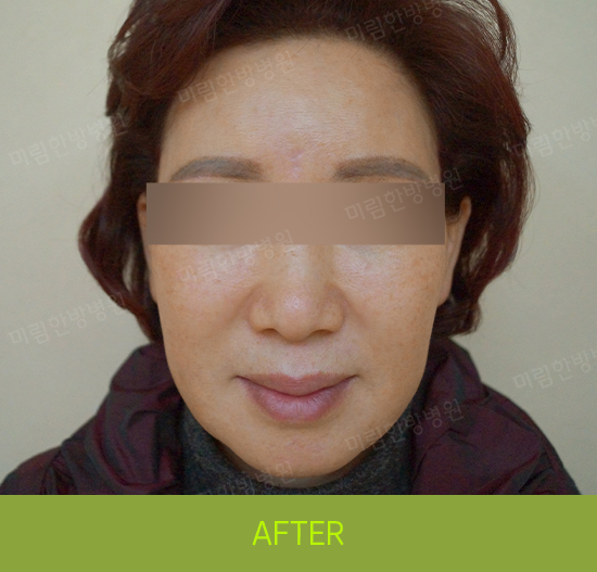 �Խñ� �����