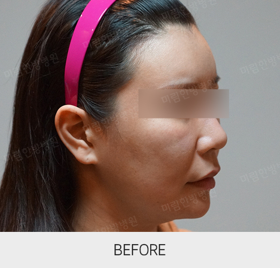 �Խñ� �����