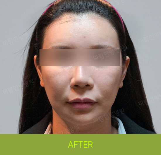 �Խñ� �����