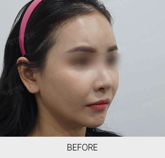 �Խñ� �����