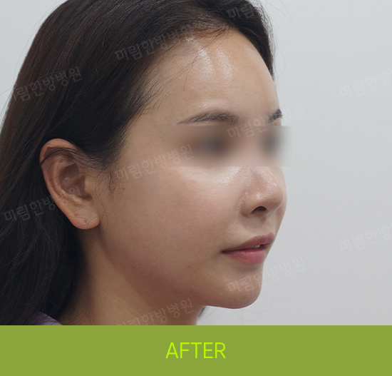 �Խñ� �����