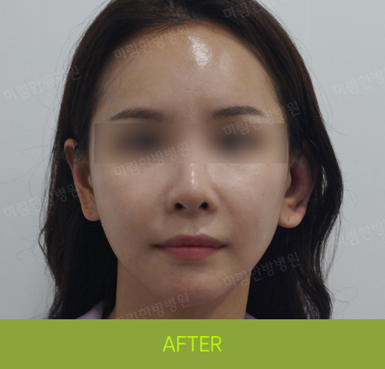 �Խñ� �����