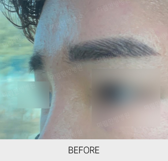 �Խñ� �����