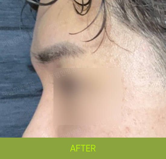 �Խñ� �����