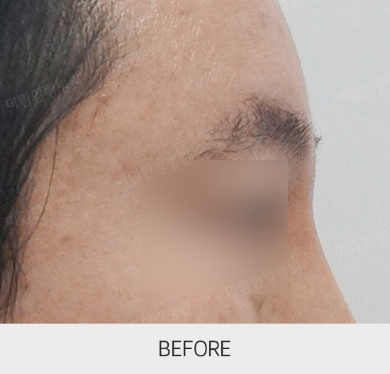 �Խñ� �����