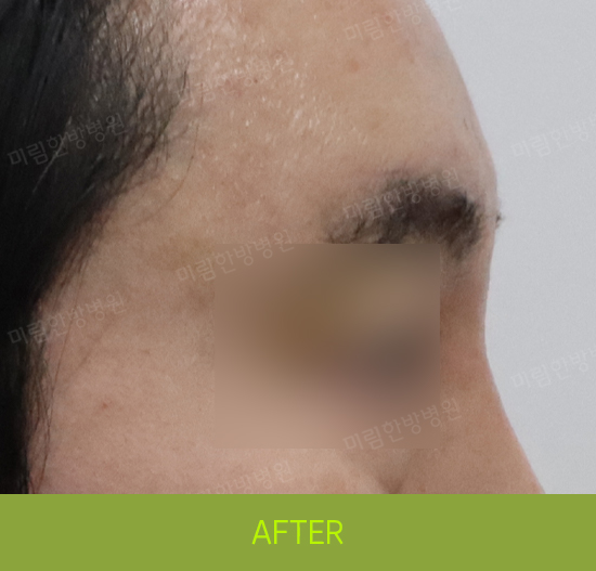 �Խñ� �����