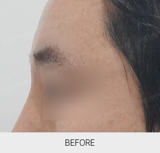 �Խñ� �����