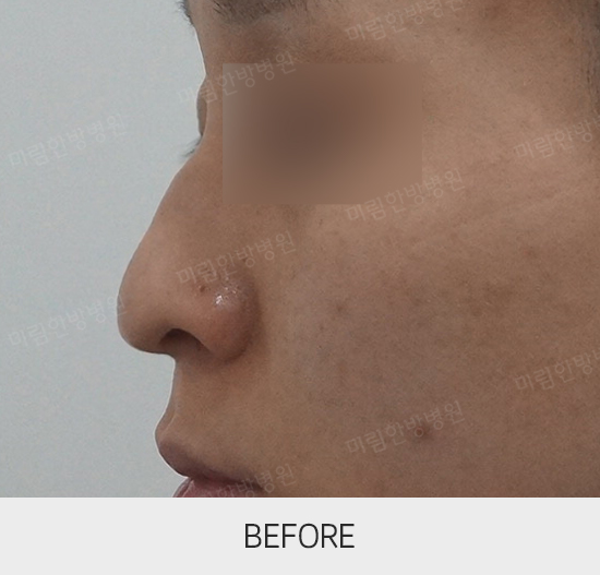 �Խñ� �����