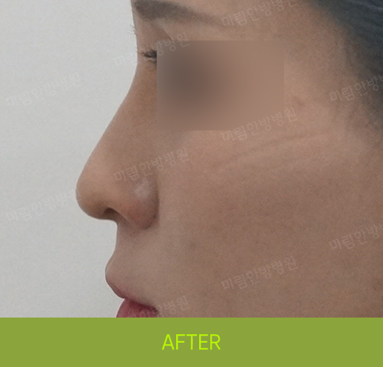 �Խñ� �����