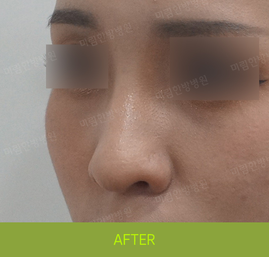 �Խñ� �����